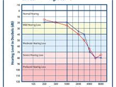 Audiogram